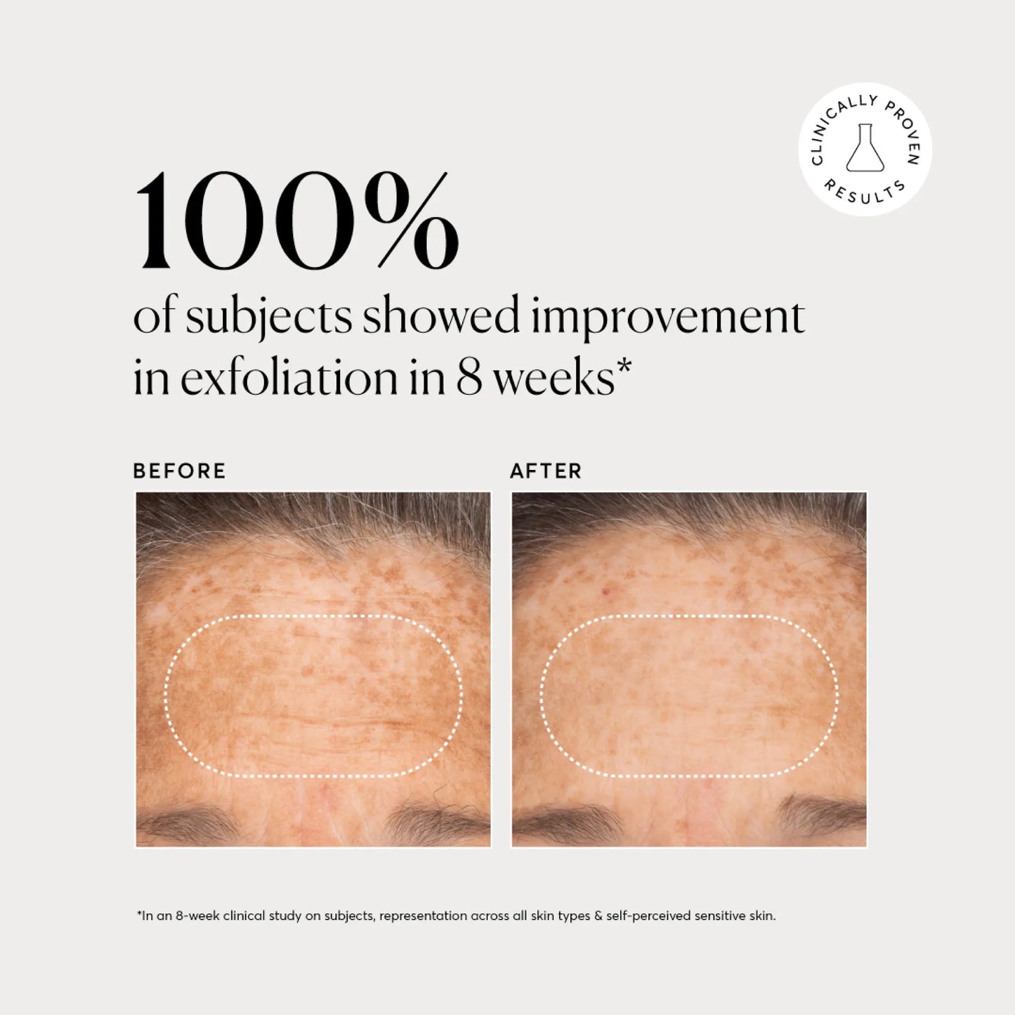 bha-liquid-exfoliant-2-d8 NATR-10027-Alt-Images-BHA-Liquid-Exfoliant-2_-03.webp